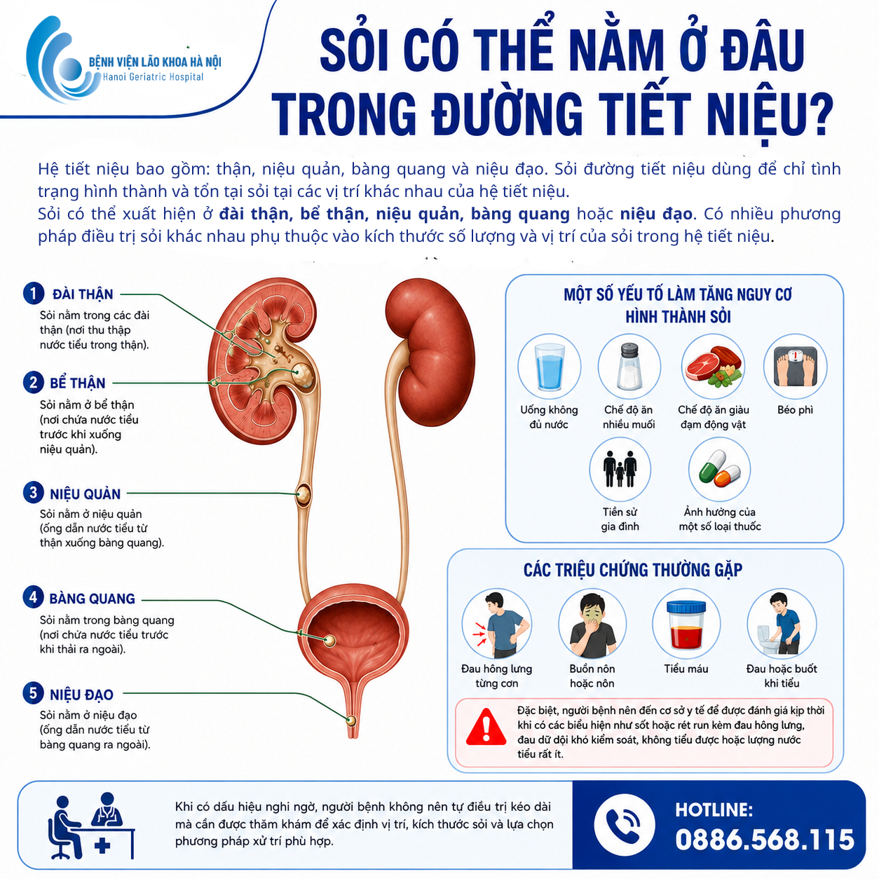 Sỏi có thể nằm ở đâu trong đường tiết niệu?